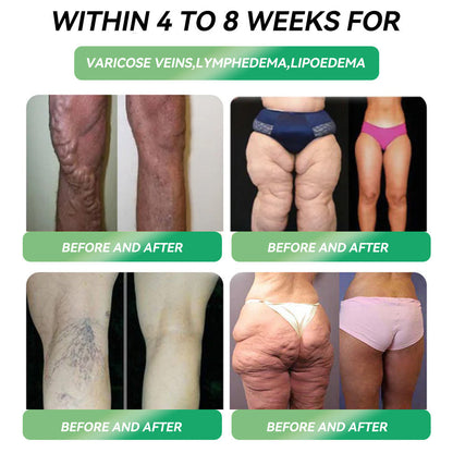 Only 10 boxes left! ⏰ Grab an exclusive 30% discount now! Endocrinologists recommend 4 to 6 boxes to stabilise weight loss and prevent rebound. Last chance before the year ends! Don’t wait any longer! 🔥